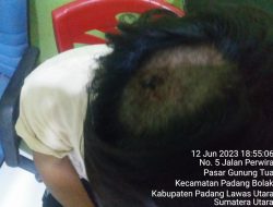 Fauzi Pulungan (20)Tahun Pedagang Sate Mengalami Kepala Bocor Setelah Dianiaya Dan Dikejar Parang